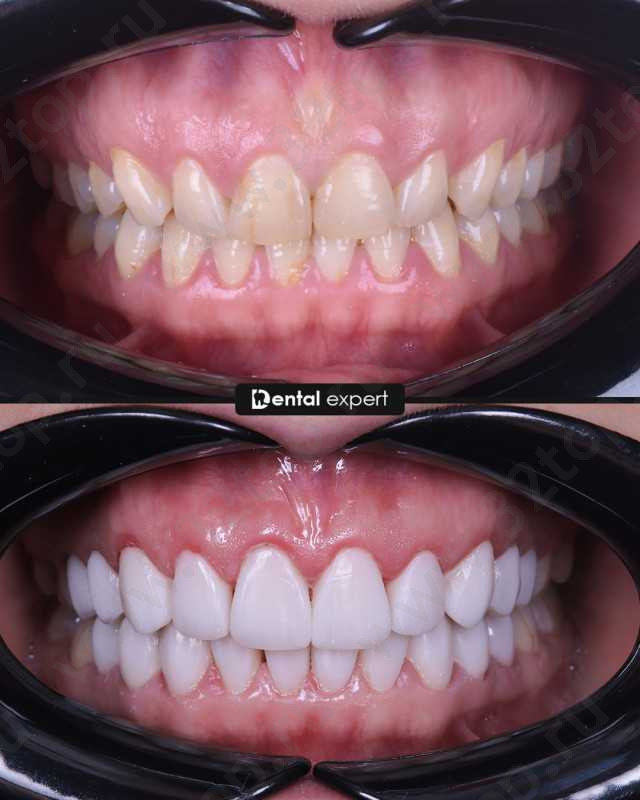 Стоматологическая клиника DENTAL EXPERT (ДЕНТАЛ ЭКСПЕРТ) 