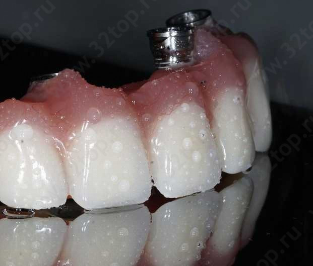 Стоматологический центр NS DENT CLINIC (НС ДЕНТ КЛИНИК) 