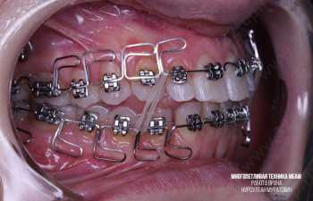 Стоматологическая клиника DENTAL EXPERT (ДЕНТАЛ ЭКСПЕРТ)