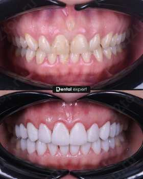 Стоматологическая клиника DENTAL EXPERT (ДЕНТАЛ ЭКСПЕРТ)