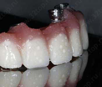 Стоматологический центр NS DENT CLINIC (НС ДЕНТ КЛИНИК)